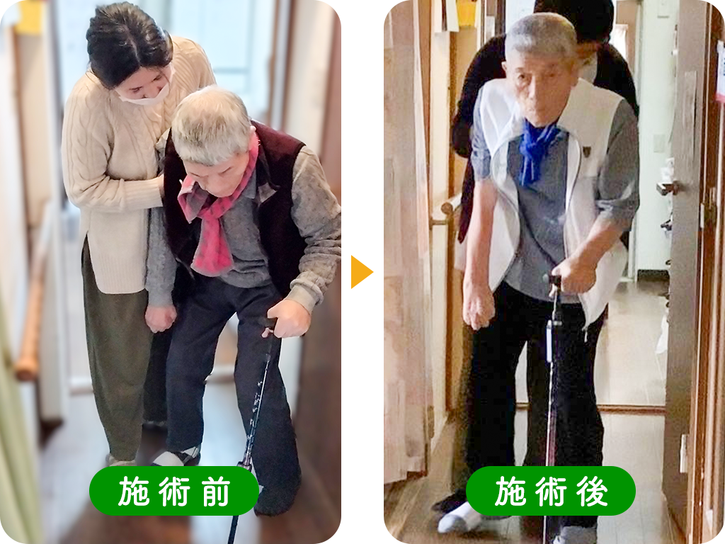 80歳代 Gさま