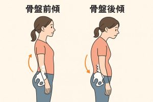 写真:骨盤の傾き(歪み)と姿勢の崩れ